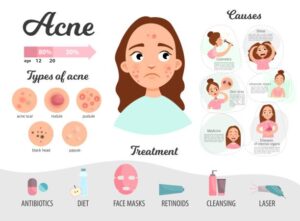 Background Of Period Acne