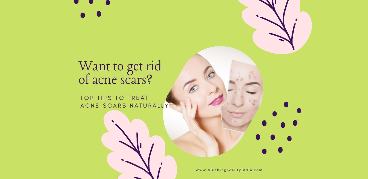 TREAT ACNE SCARS NATURALLY