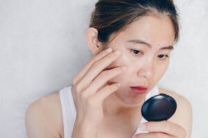 puffiness and under eye circles