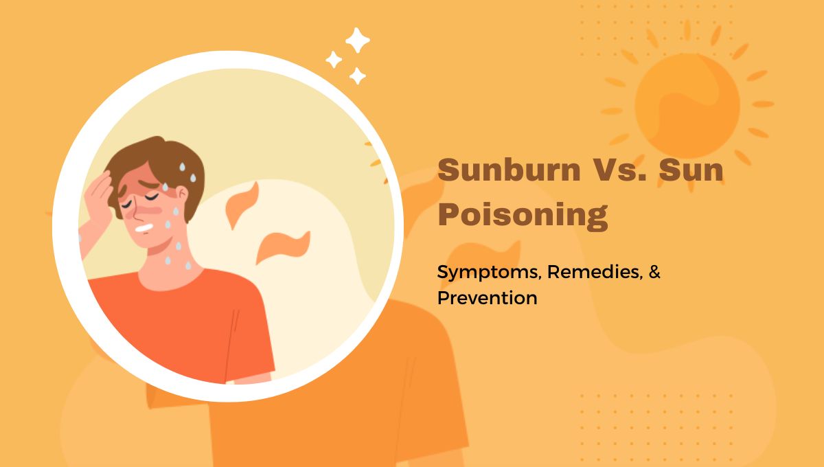 Sunburn Vs. Sun Poisoning