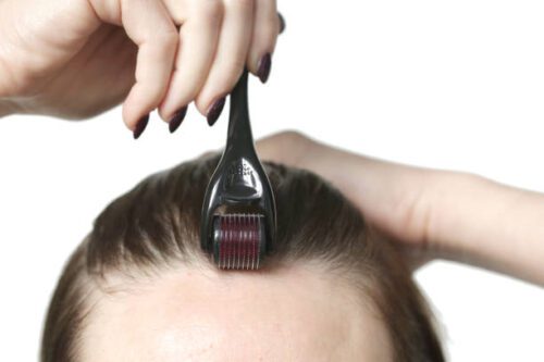 Derma Rollers for Hair Loss