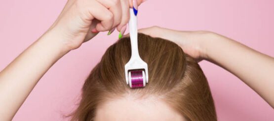 How Does a Derma Roller Work for Hair Loss