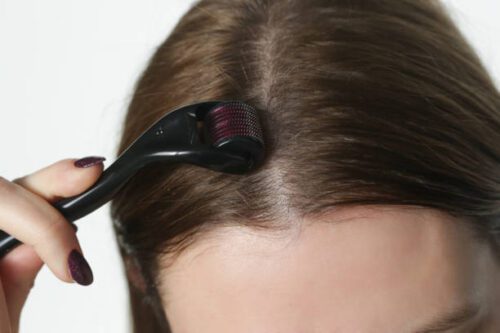 Scientific Evidence to Support the Use of Derma Rollers for Hair Loss