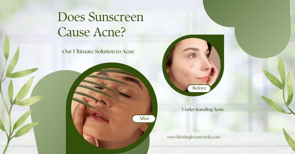 sunscreen cause acne