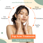 Top Acne  Treatments That Actually Work: Clear Skin Starts Here